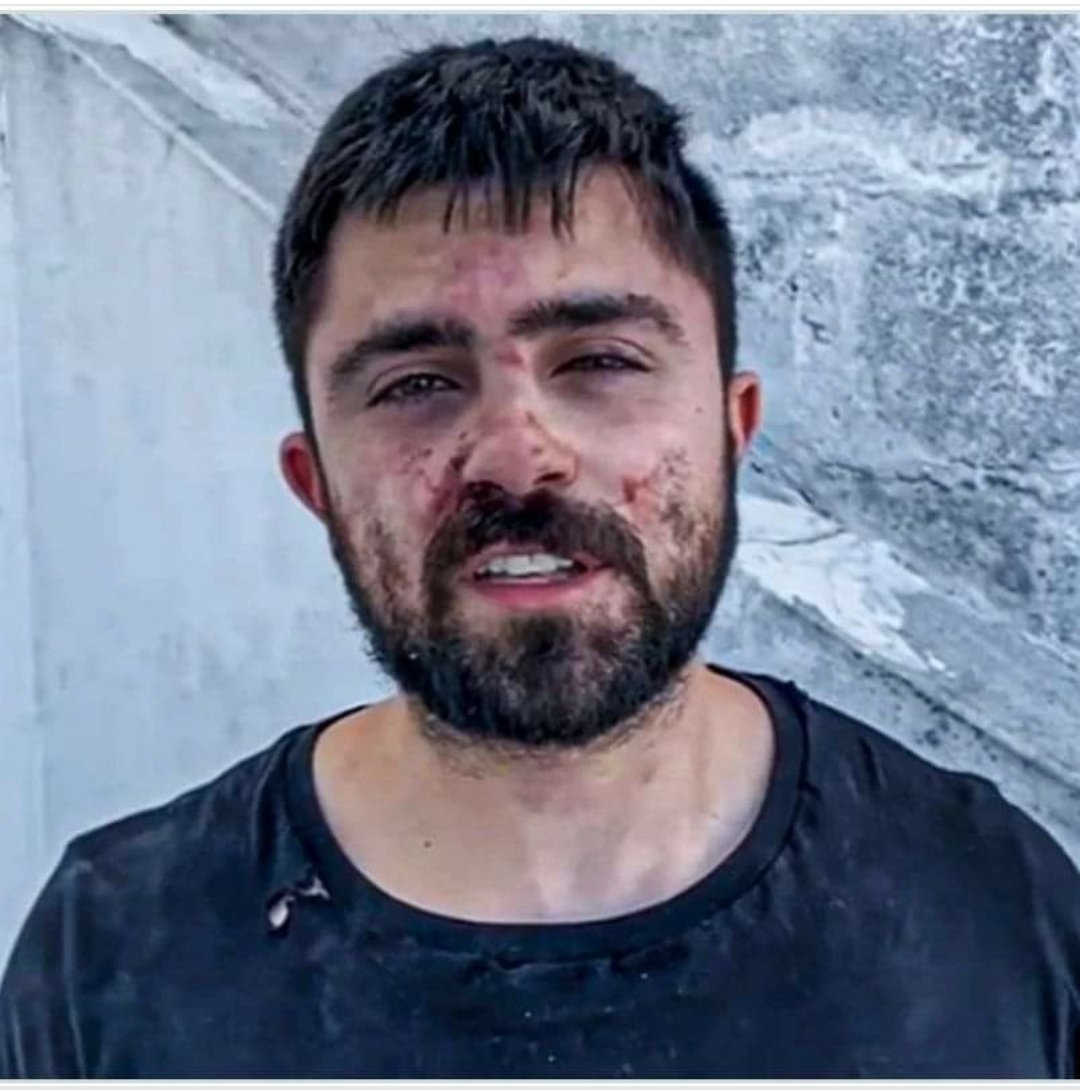 Militante do MBL foi agredido na Universidade de Santa Catarina